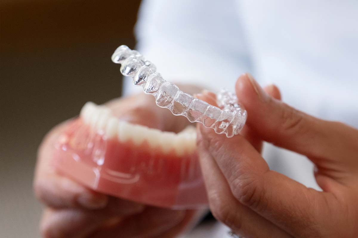 Hand holding a pair of Invisalign aligners